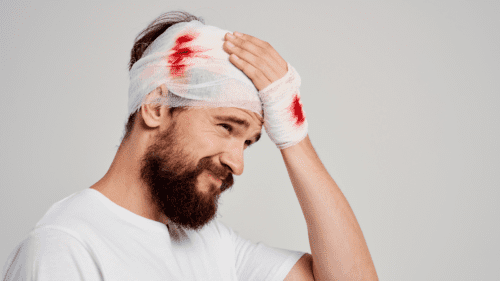 Common Types of Brain Injuries After an Auto Accident