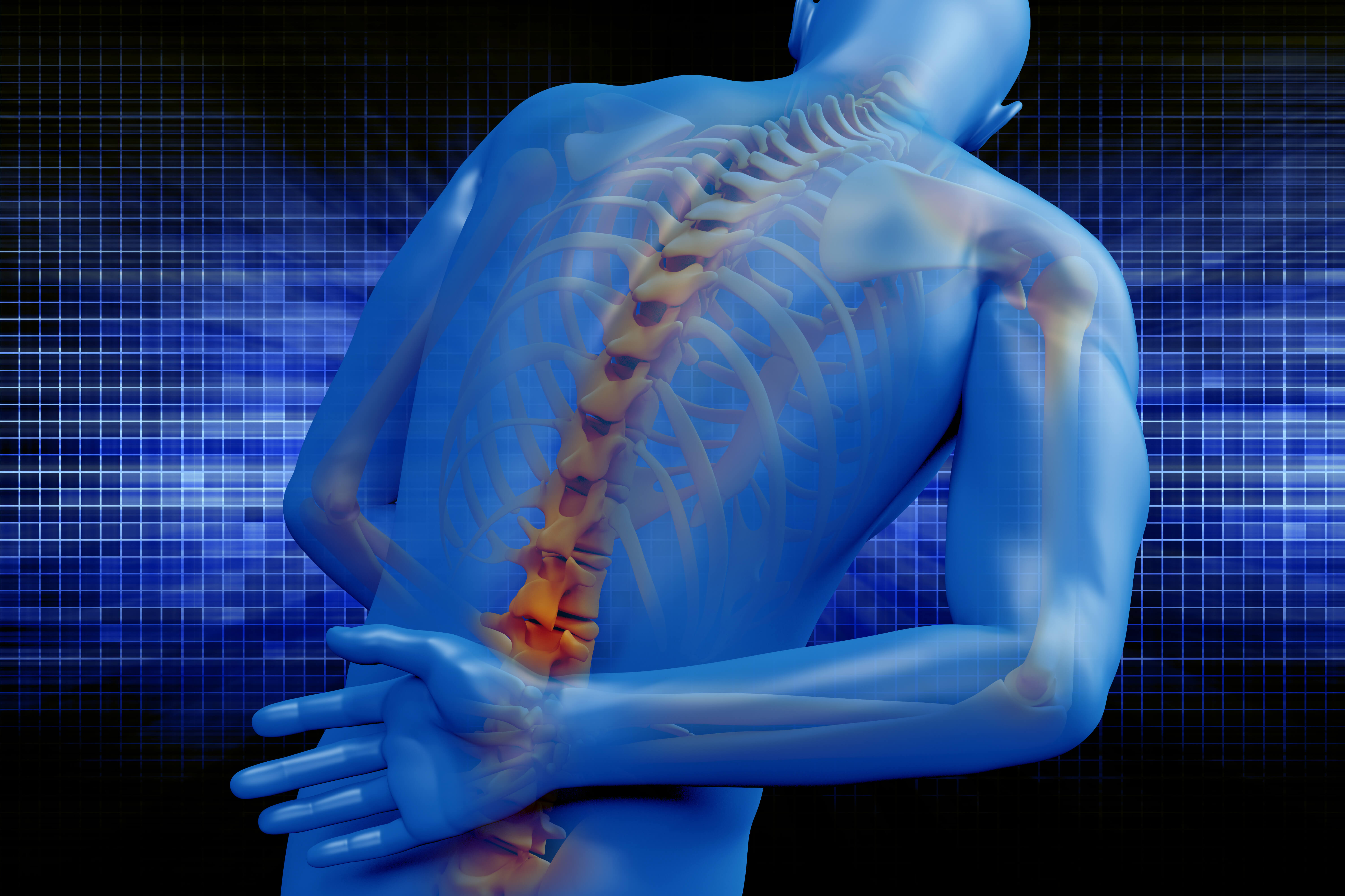 Backside Injury Proving a Back Injury After a Car Accident - MG Law