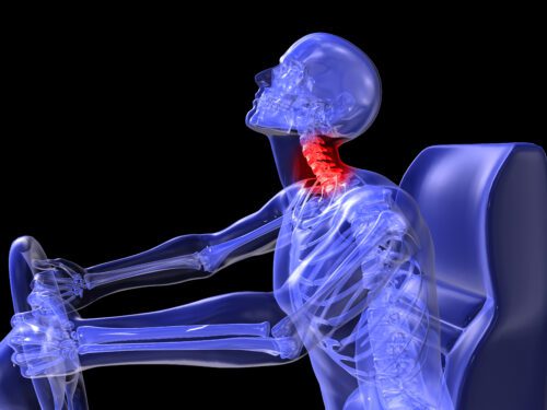 Can Symptoms of Whiplash Be Delayed